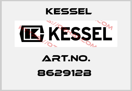 Art.No. 862912B  Kessel